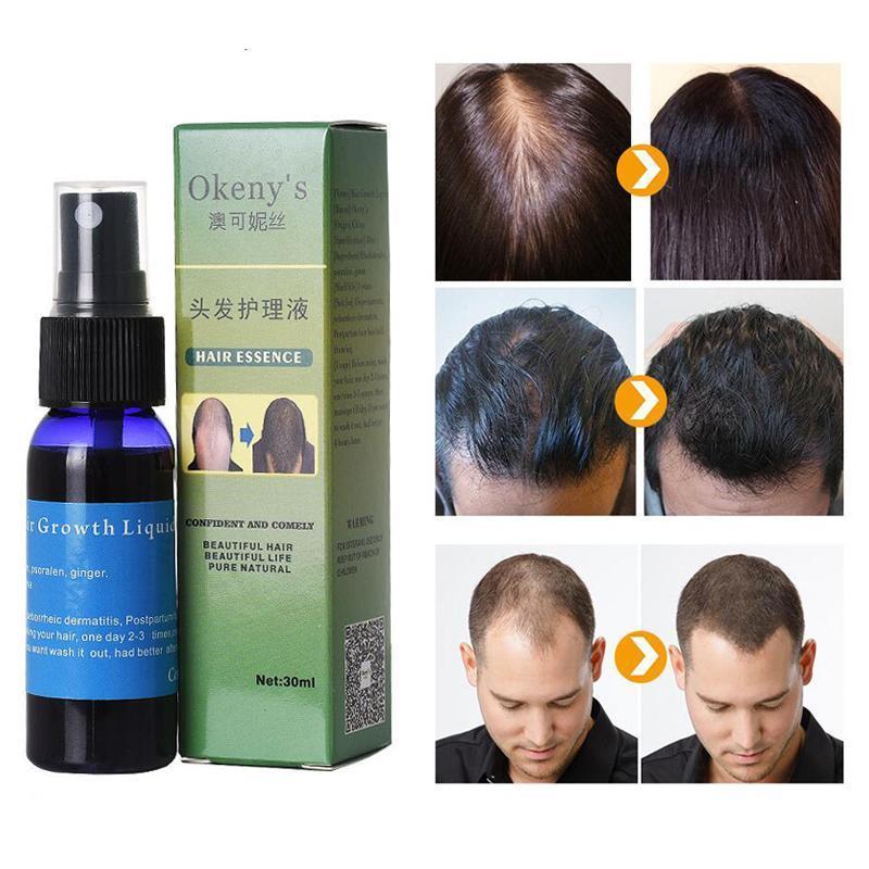 Herbal Hair Growth & Anti-Hair Loss Spray Oil
